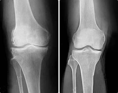 Joint recovery documentation for active professional